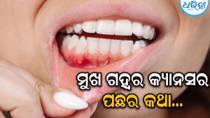ମୁଖ ଗହ୍ବର କ୍ୟାନ୍‌ସର ପଛର କିଛି କଥା…