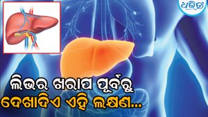 ଲିଭର ଖରାପ ହେବାର ଦଶ ଦିନ ପୂର୍ବରୁ ଦେଖାଦିଏ ଏହି ଲକ୍ଷଣ…