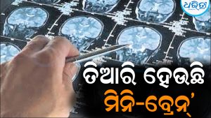 ଲାବ୍‌ରେ ତିଆରି ହେଉଛି ‘ମିନି-ବ୍ରେନ୍‌’: ଜାଣିଲେ ହେବେ ଆଶ୍ଚର୍ଯ୍ୟ