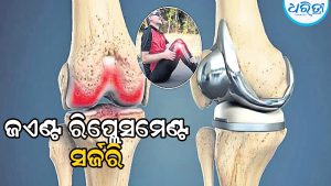 ଜଏଣ୍ଟ ରିପ୍ଲେସମେଣ୍ଟ ସର୍ଜରି
