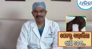 ୧୧ ବର୍ଷ ଧରି କେଶ ଖାଉଥିଲେ ଛାତ୍ରୀ; ଏବେ ଡାକ୍ତର ତାଙ୍କ ପେଟରୁ ବାହାର କଲେ ୧.୧୬ କିଲୋଗ୍ରାମର ଗଣ୍ଠି