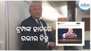 ଭାଇରାଲ୍ ହେଉଛି ଟ୍ରମ୍ପଙ୍କ ହାତର ଫଟୋ; ଗଭୀର ଚିହ୍ନଙ୍କୁ ନେଇ ବଢ଼ିଲା ଚର୍ଚ୍ଚା