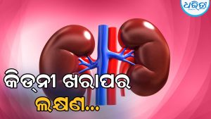 କିଡ୍‌ନୀ ଖରାପ ହେଲେ ଆରମ୍ଭରୁ ଦେଖାଦିଏ ଏସବୁ ଲକ୍ଷଣ…